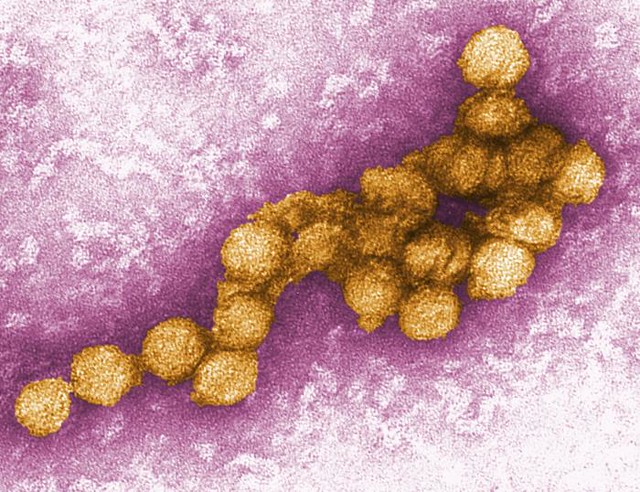 spain-reports-2020’s-first-death-due-to-west-nile-virus-amid-covid-19-pandemic