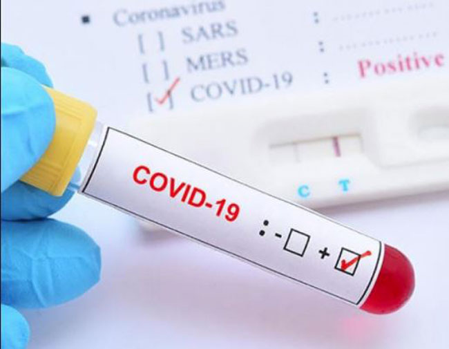 global-coronavirus-cases-near-2.5-crore:-johns-hopkins